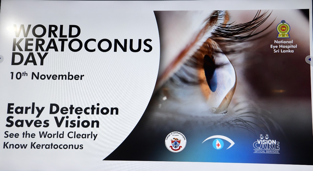 ශ්‍රී ලංකාවේ දී ප්‍රථමවරට ලෝක කෙරටකෝනස් දිනය සමරයි