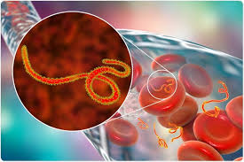 ඉබෝලා වෛරසය පිළිබඳව විශේෂ නිවේදනයක් 